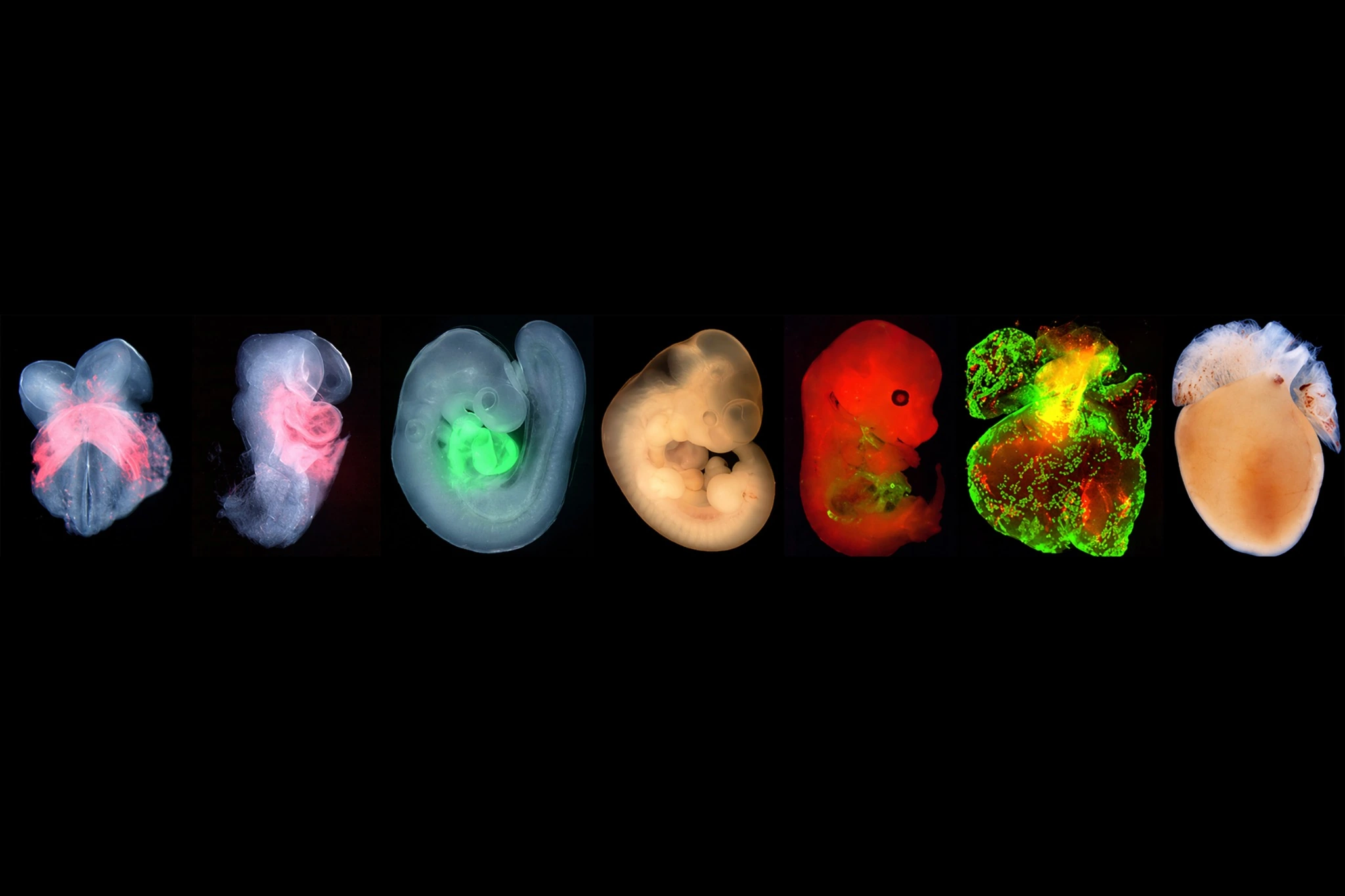 Composite of seven embryonic heart and embryo specimens shown across developmental stages and fluorescence-imaging conditions.